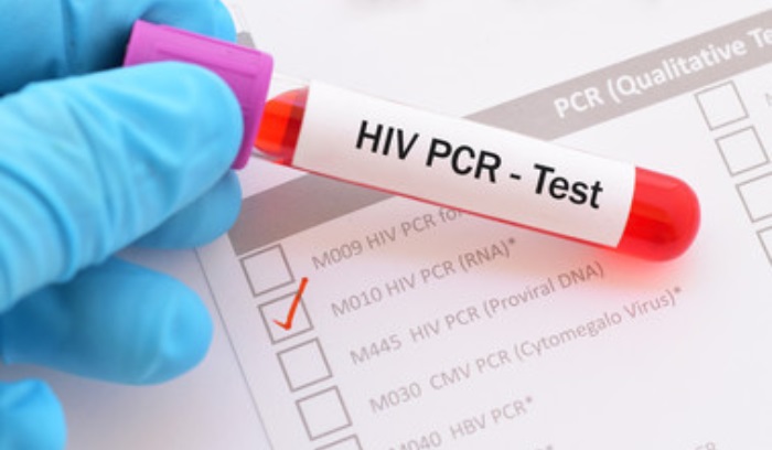عاجل زحمة سيارات أمام مستشفى سيّدة المعونات في جبيل بسبب توافد المواطنين لإجراء فحص الPCR