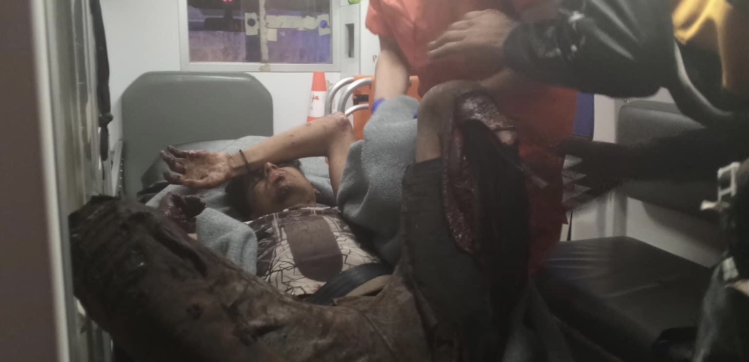 الغام أرضيه تنفجر بالنازحين العابرين من سوريا إلى لبنان في معبر المتحده